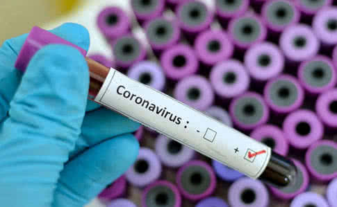 В Крыму под наблюдением из-за коронавируса находятся 50 человек