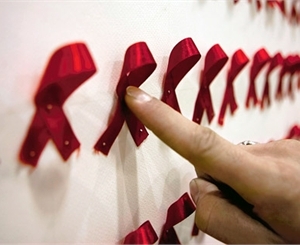 Музыканты помогут побороть СПИД. Фото с сайта aids-info.ru
