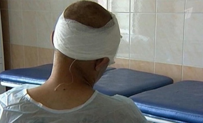 В Симферополе посетителя из кафе увезли в больницу с серьезными травмами головы